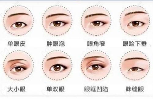 眼综合.jpg