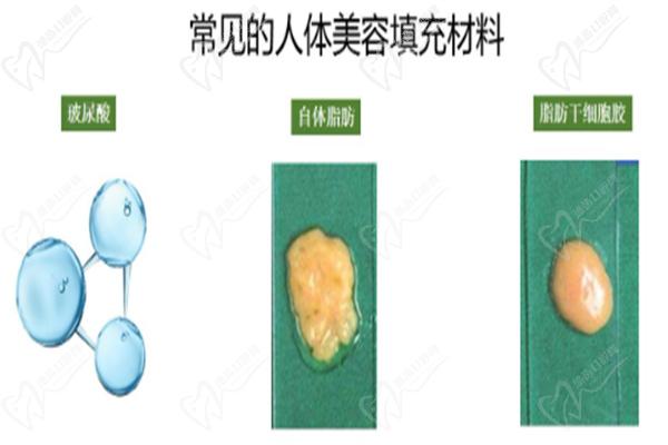 深圳脂肪填充好的医生是哪家