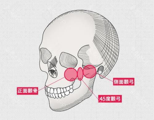 南京金柱翰磨骨技术怎么样