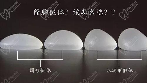 曼托假体分为哪几种,价格都是多少呢 曼托假体分为哪几种,价格都是多少呢