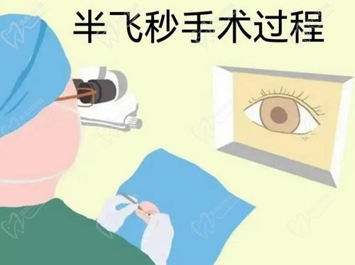 银川进川眼科医院张旭斌擅长做近视手术的技术娴熟