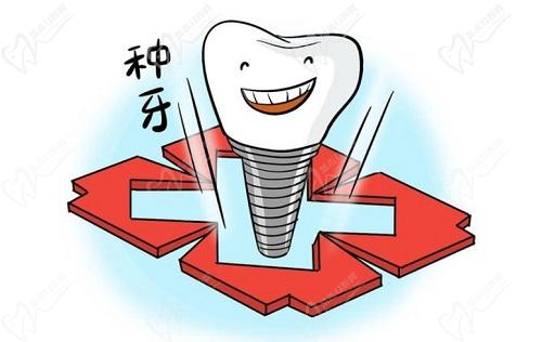 西宁非凡口腔医院张雷医生口碑评价