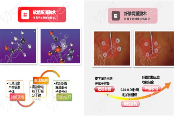 来维密金雕馒化治疗