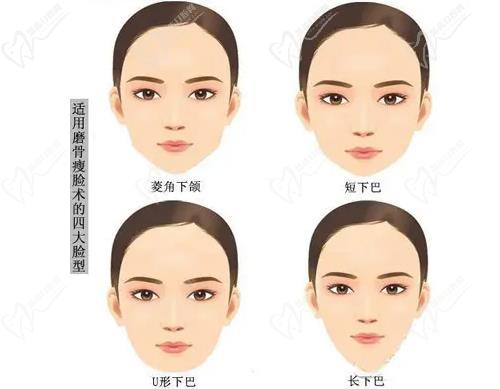 金柱翰磨骨风格