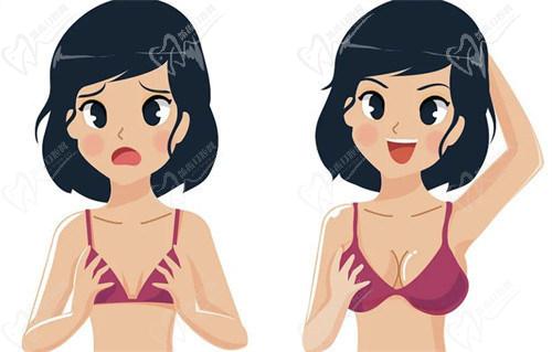 李高峰医生隆胸技术好吗？