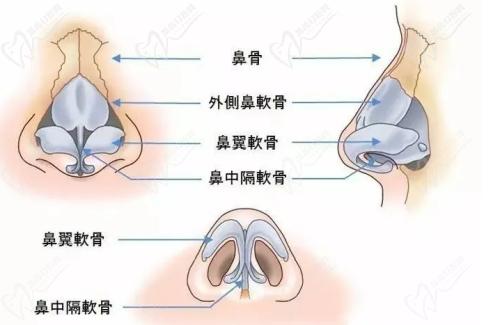 武汉同 济吴辉医生做鼻子的技术扎实