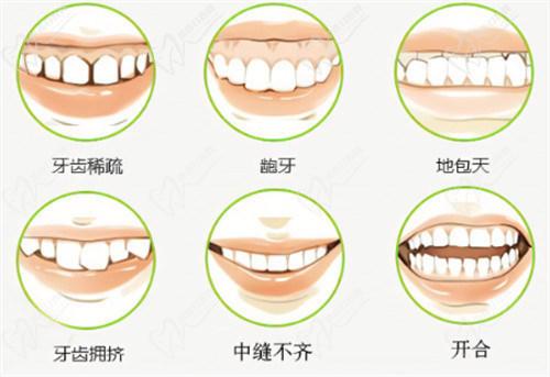 (三)吉林市张杰口腔美白牙齿价格表2025：