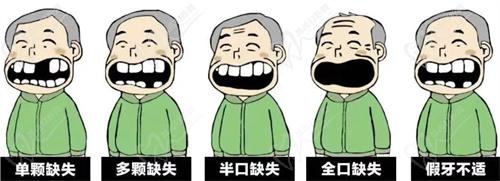 邢尚涛医生做种植牙技术怎么样？