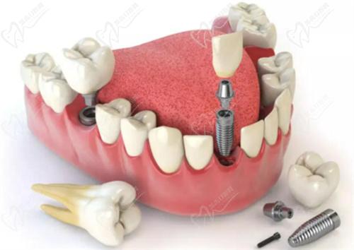青岛可恩口腔哪个医生口碑好？