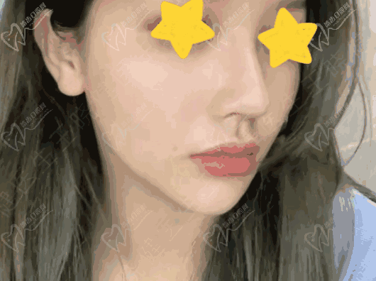 王晓健人中缩短术在哪个医院