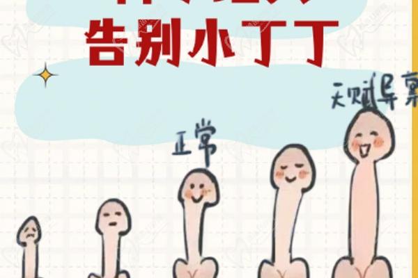 张国喜做男性假体植入术病例