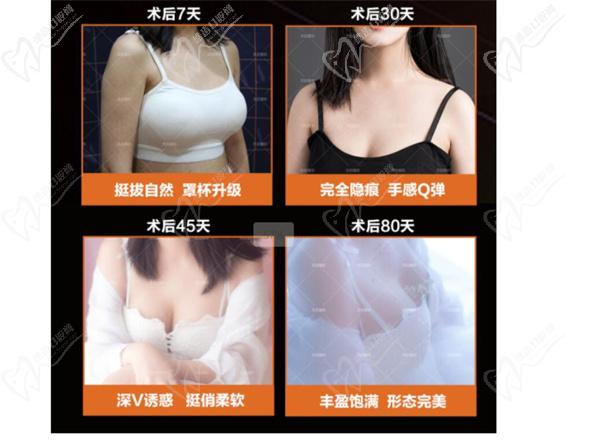 陈三群手术案 例