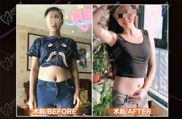 陈三群手术案 例