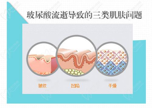 武汉美莱申玲医生擅长项目价格 武汉美莱申玲医生擅长项目价格