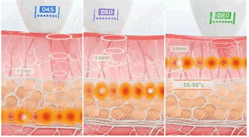 武汉美莱申玲医生技术高超 武汉美莱申玲医生技术高超