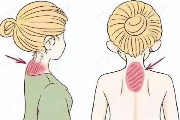 上海吴友勇富贵包治疗怎么样 上海吴友勇富贵包治疗怎么样