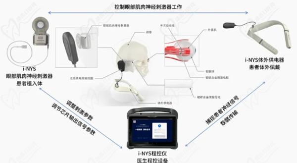 王乐今INYS植入技术