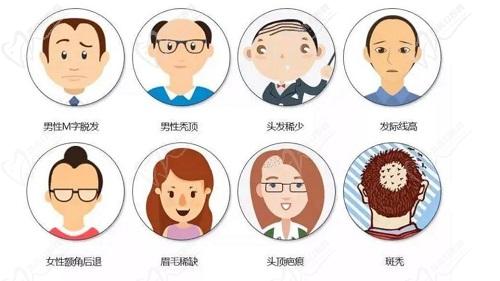 潘成城植发技术优势