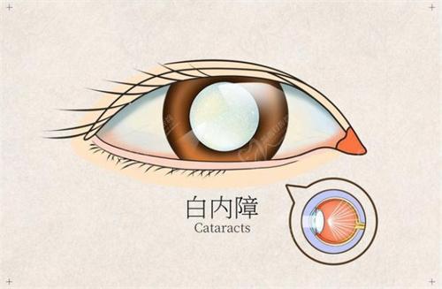 亳州市人民 医院眼科陆颖丽医生口碑评价
