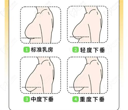  西安画美整形医院隆胸手术价格：透明公开，合理收费