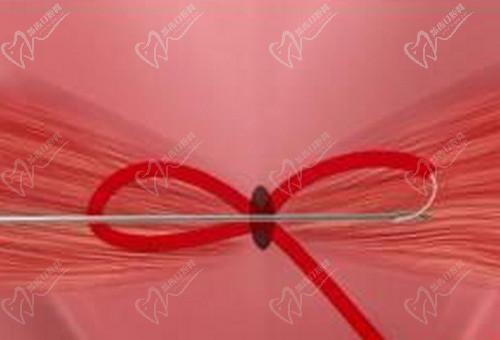 武汉真爱妇产医院私密整形做阴道紧缩手术经验多