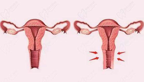 武汉真爱妇产医院龚美云医生的私密整形技术好