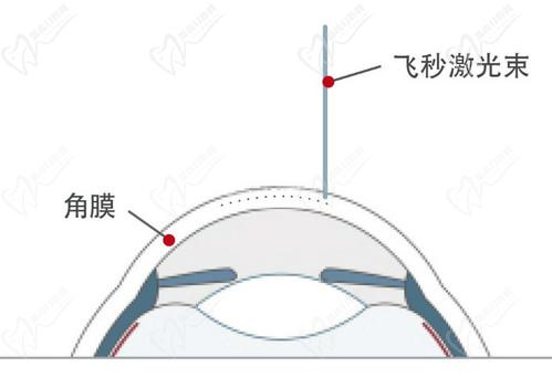 石家庄爱眼眼科魏玲医生技术扎实