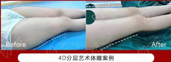 武汉刘骏超脂塑体雕技术优势及实例分享
