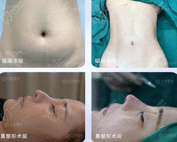 武汉江城刘骏整容失败修复技术优势