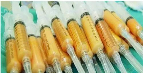 江城整形刘骏医生艺术脂雕价格