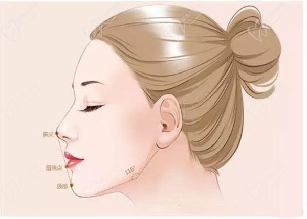 范荣杰鼻子整形