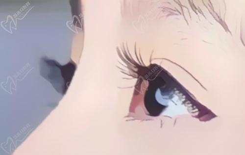 贵港华美医疗陈先才医生擅长做双眼皮手术 贵港华美医疗陈先才医生擅长做双眼皮手术