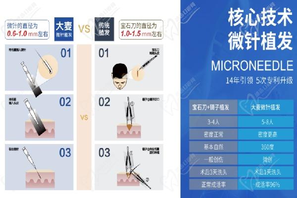 成都植发医院哪家好怎么选