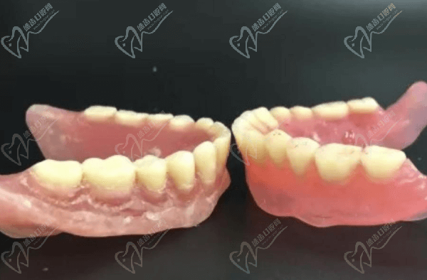 长沙美奥口腔医院吸附性义齿怎么样？