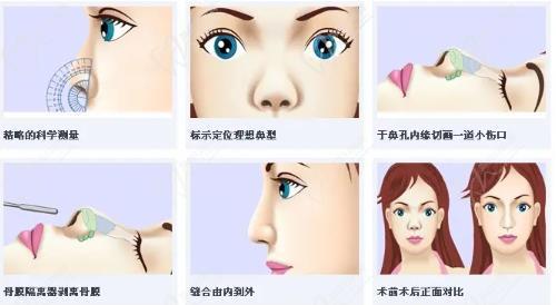 杭州艺星汪云锋