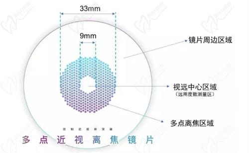 二、十大品牌近视镜片详细介绍：