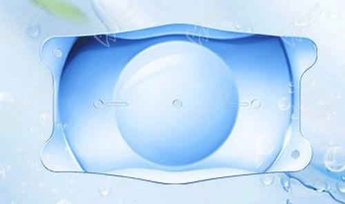 ICL晶体植入手术