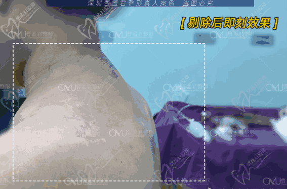 曹孟君院长在哪坐诊
