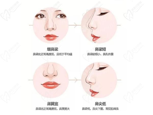 常州曙光整形鼻部综合项目