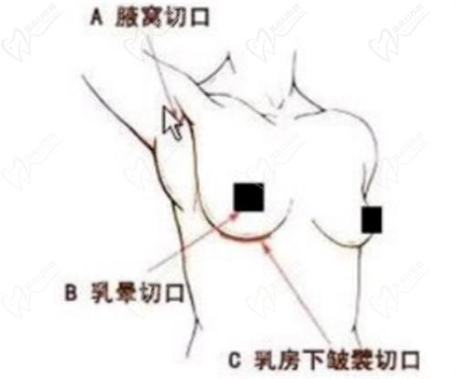 诺拉星熠光面中凸290cc怎么样
