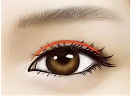 安康维美丽莎美容彭以建的眼整形技术娴熟