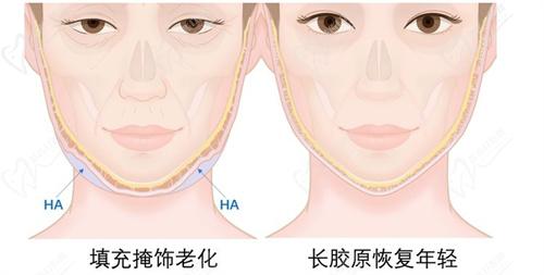钟杰光修复馒化好吗