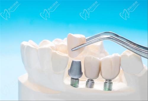 太原爱德口腔门诊部正规吗