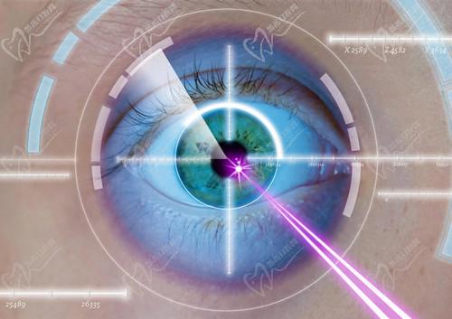 武汉华厦眼科医院何小阳做近视手术的技术不错