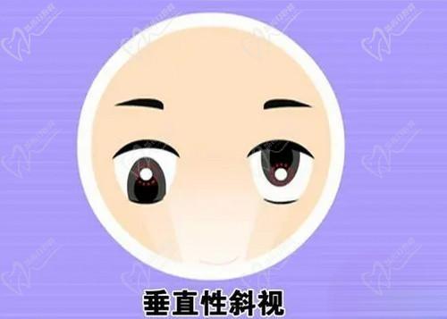 武汉华厦眼科医院戴鸿斌院长斜视矫正手术价格
