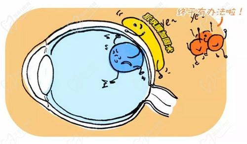 武汉华厦眼科医院戴鸿斌医生做后巩膜加固手术技术娴熟