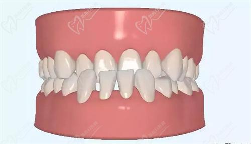 北京冠美口腔总部平乐园店怎么去