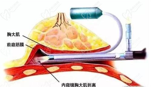 林沸腾医生目前主要在福州海峡医疗美容医院坐诊。