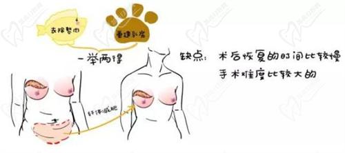 林沸腾隆胸排名:国内十大隆胸医生