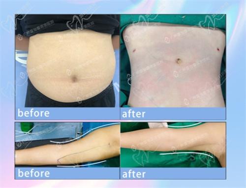 如何预约壹加壹脂雕美塑节活动